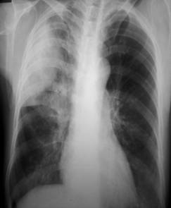 100张典型X线图片