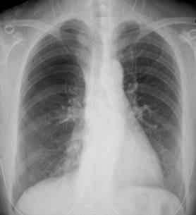 100张典型X线图片