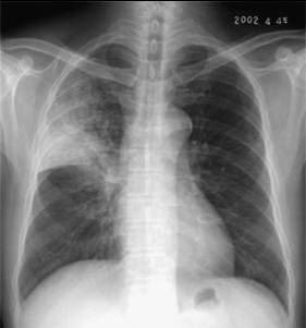 100张典型X线图片