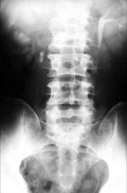 100张典型X线图片