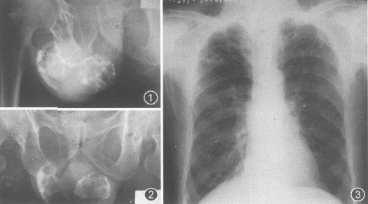 100张典型X线图片