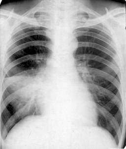 100张典型X线图片