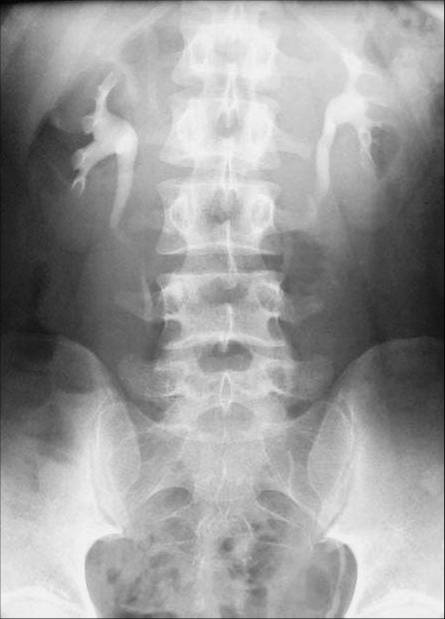 100张典型X线图片