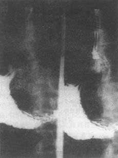 100张典型X线图片