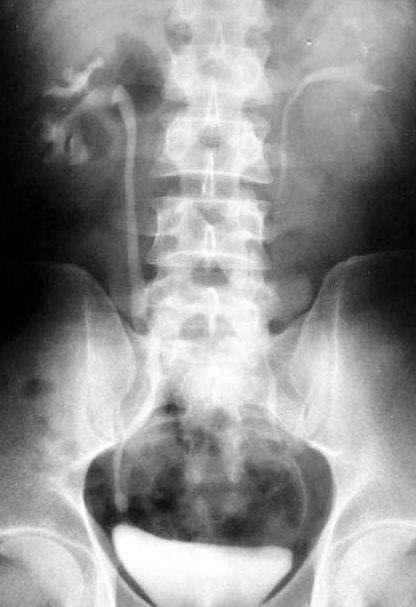 100张典型X线图片