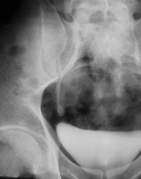 100张典型X线图片