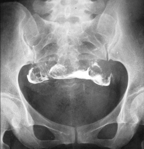 100张典型X线图片