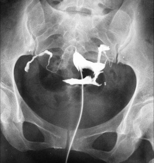 100张典型X线图片