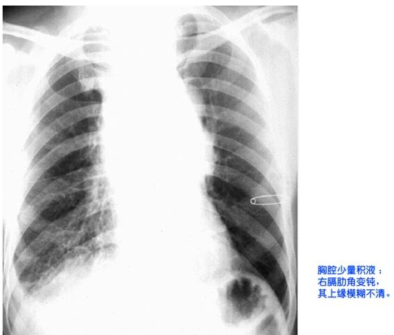 100张典型X线图片