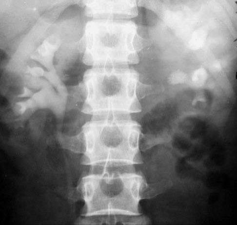100张典型X线图片