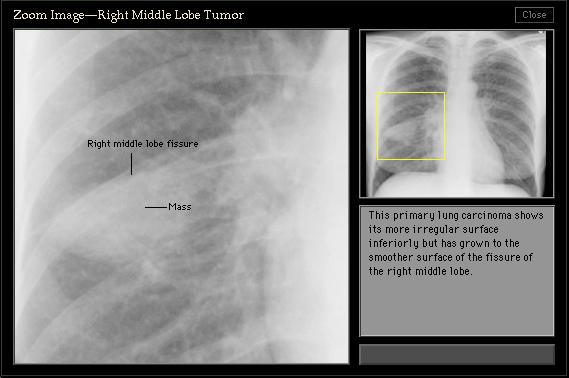 100张典型X线图片