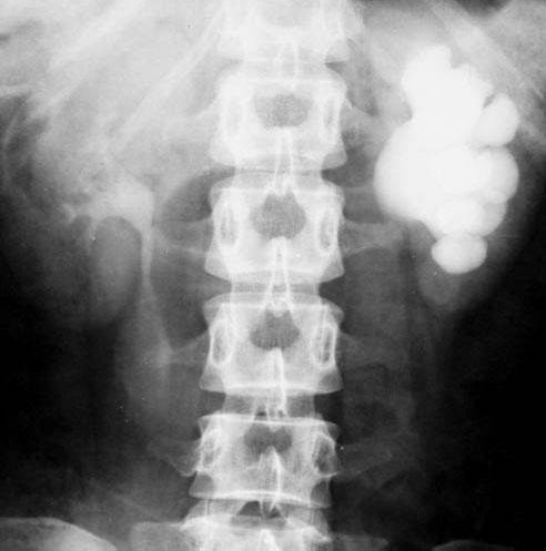 100张典型X线图片