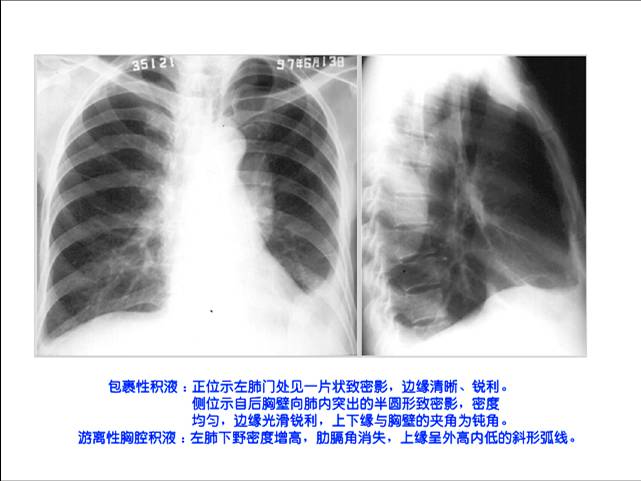 100张典型X线图片