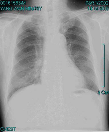 100张典型X线图片
