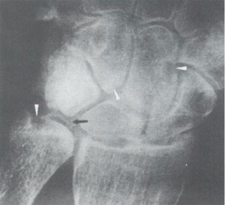 100张典型X线图片