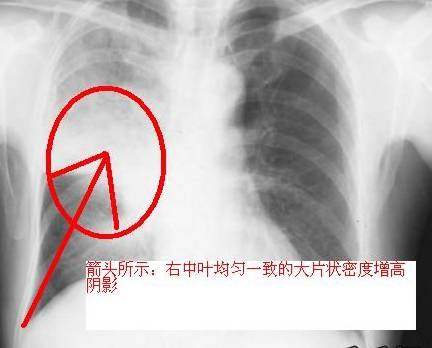 100张典型X线图片