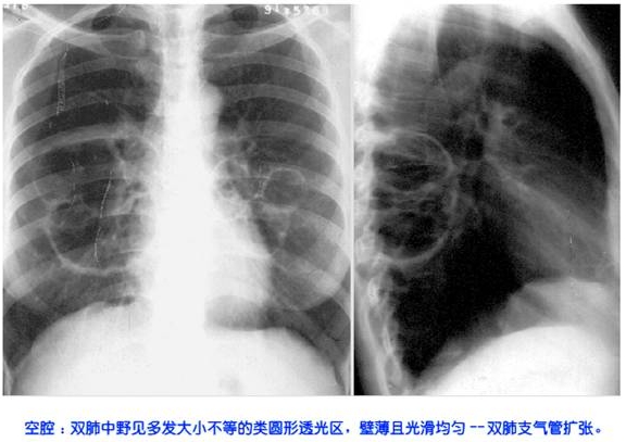 100张典型X线图片