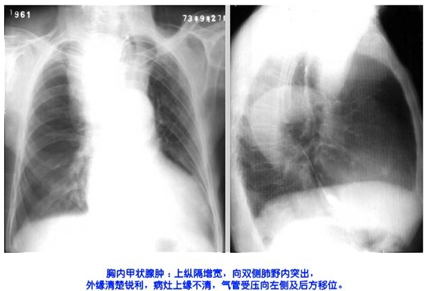 100张典型X线图片