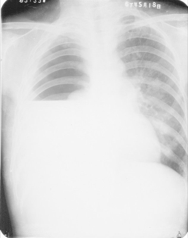 100张典型X线图片