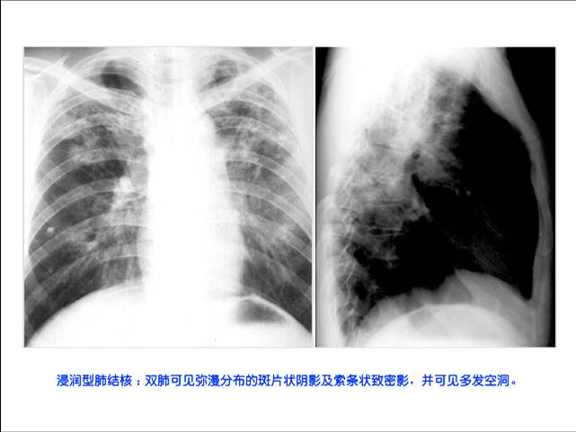 100张典型X线图片