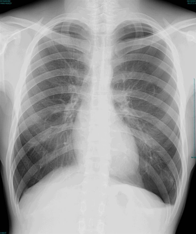 100张典型X线图片