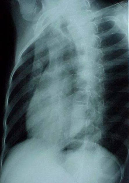 100张典型X线图片