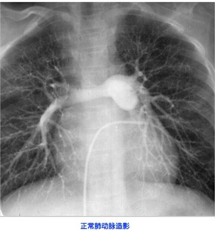 100张典型X线图片