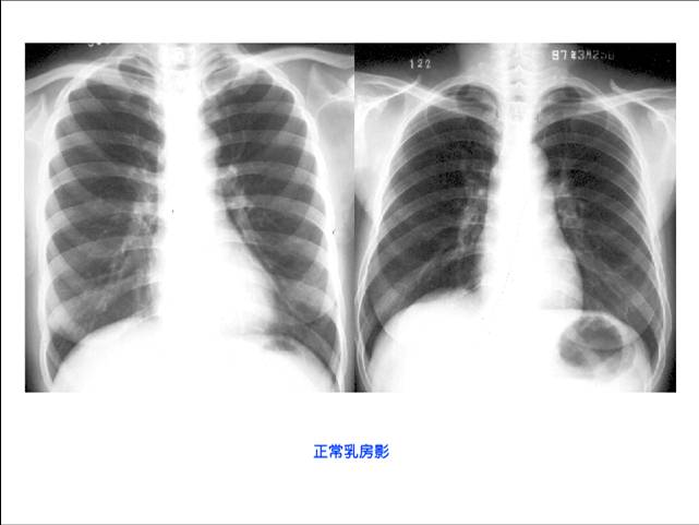 100张典型X线图片