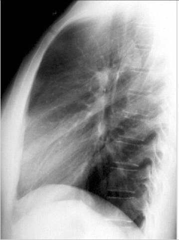 100张典型X线图片