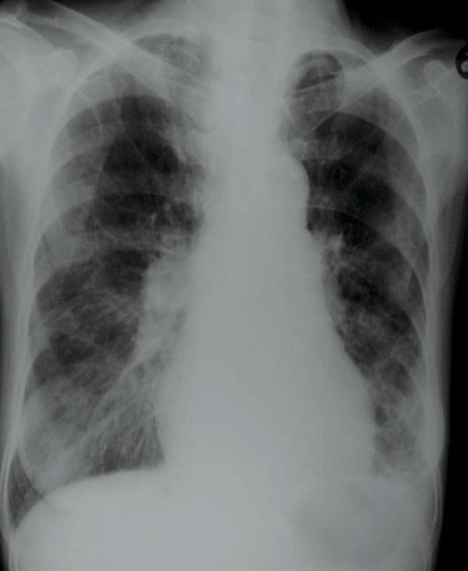 100张典型X线图片