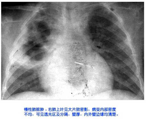 100张典型X线图片