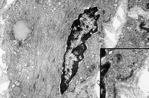 100张典型X线图片