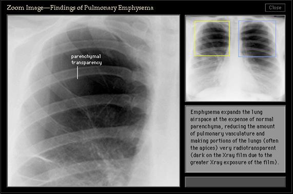 100张典型X线图片