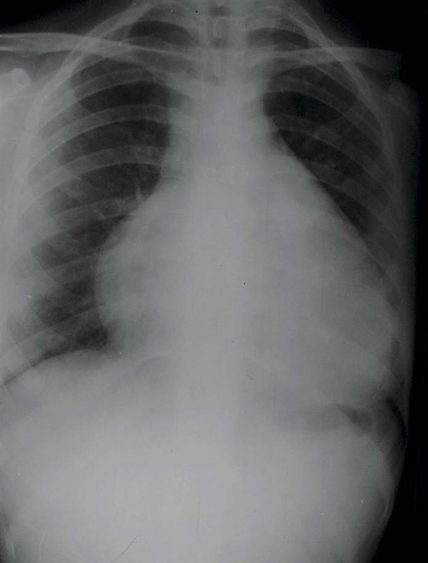 100张典型X线图片