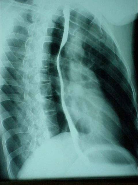 100张典型X线图片