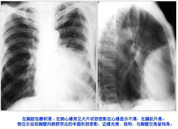 100张典型X线图片