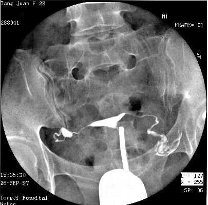 100张典型X线图片