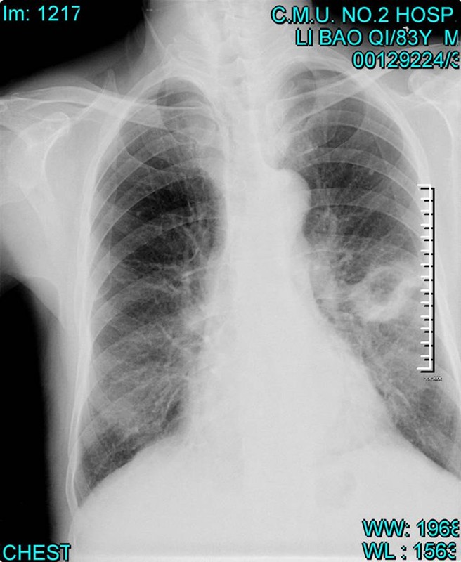 100张典型X线图片