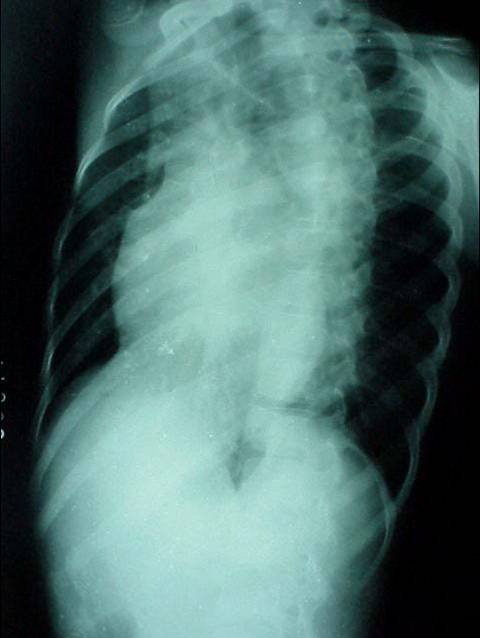 100张典型X线图片