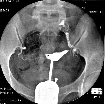 100张典型X线图片