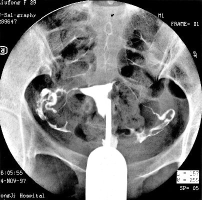 100张典型X线图片