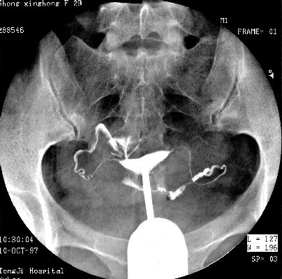 100张典型X线图片