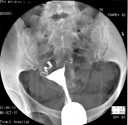 100张典型X线图片