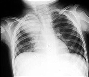 100张典型X线图片