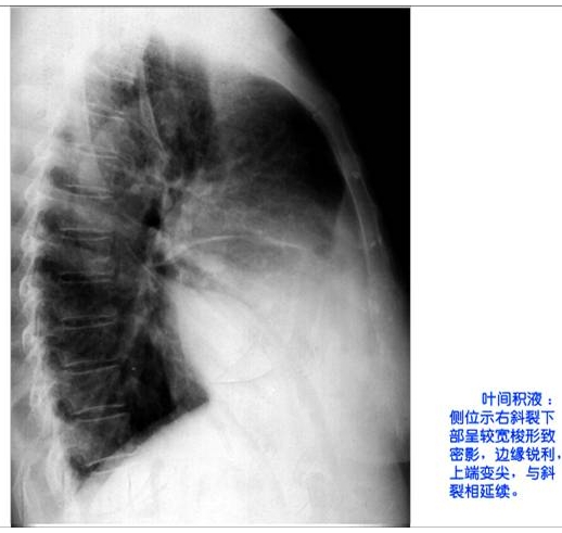 100张典型X线图片
