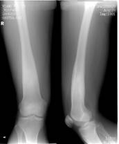 100张典型X线图片
