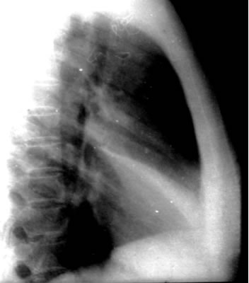 100张典型X线图片