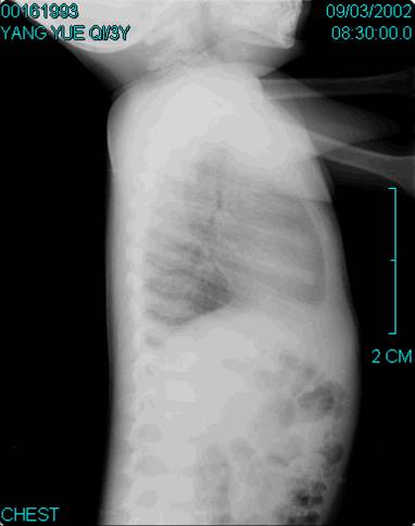100张典型X线图片