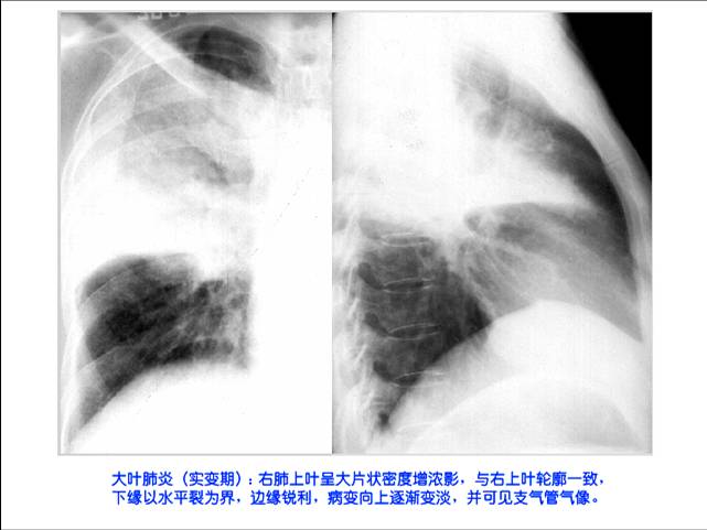 100张典型X线图片