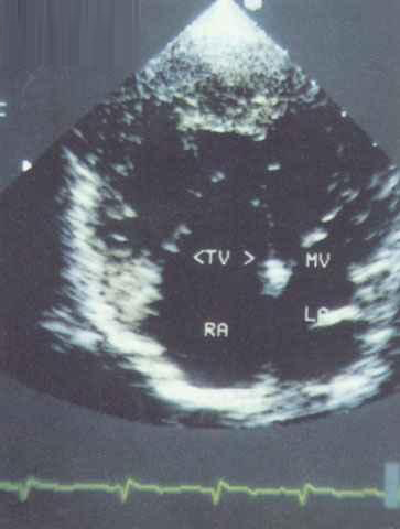 100张典型X线图片